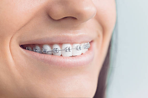 Best Dental Fillings (Composite and Amalgam)  in Apalachin, NY